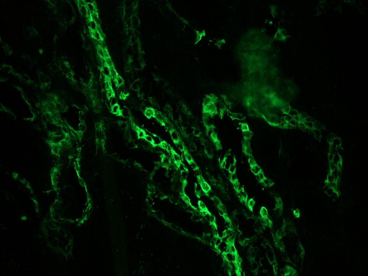 Figure 7. MUB0316P (clone OVTL12-30)  indirect immunofluorescence staining of a frozen section of human kidney at a 1:500x dilution. Note only strong reactivity in the epithelial ducts and no staning in connective tissue or glomeruli.